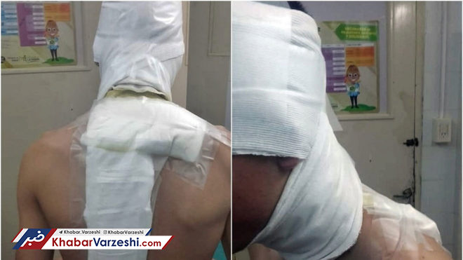 عکس| حمله با آب جوش به بازیکنان در لیگ آرژانتین