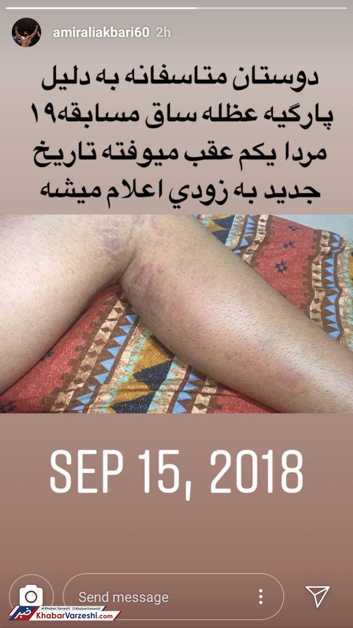 عکس| مصدومیت شدید امیر علی اکبری