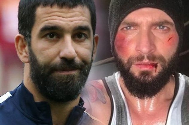 تصاویر جدید از حمله آردا توران به خواننده ترک