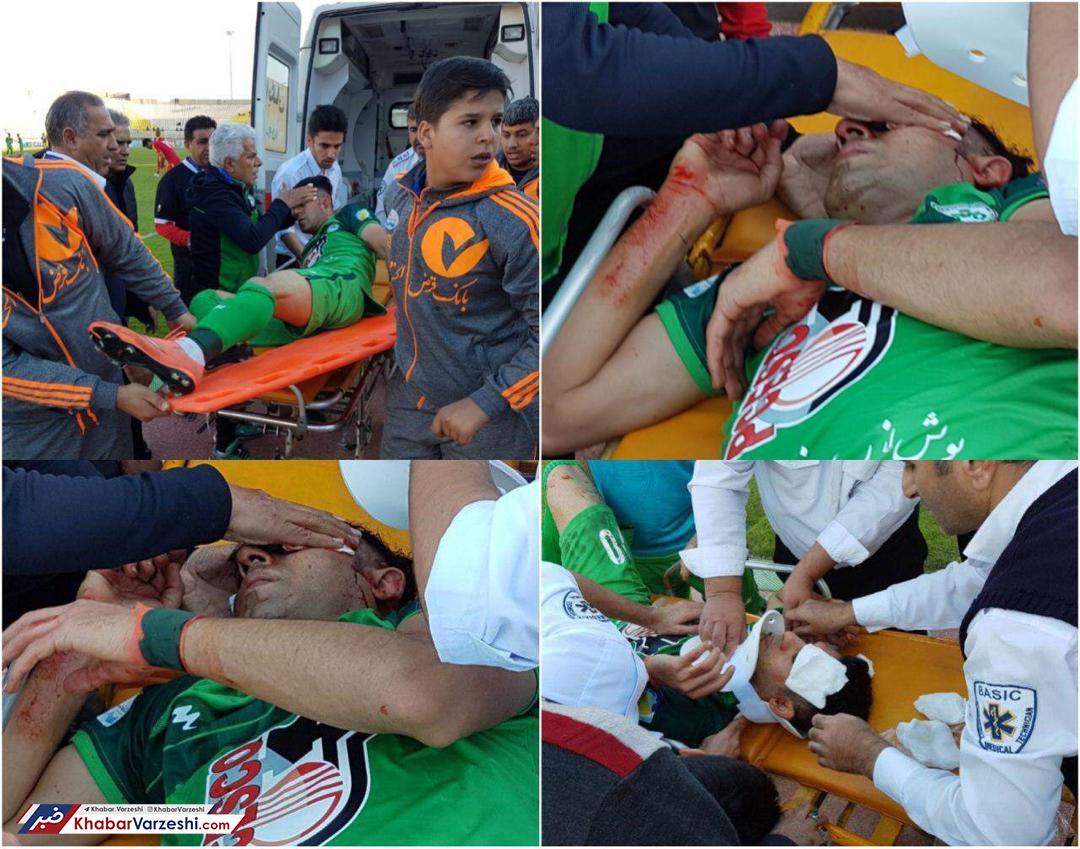 عکس| آسیب‌دیدگی خونین مهاجم ذوب‌آهن