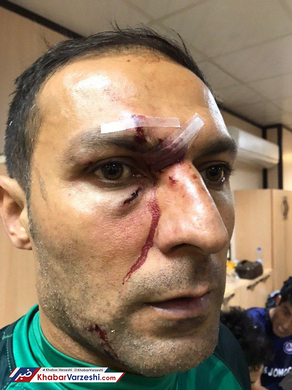 عکس| مصدومیت دلخراش رحمان احمدی