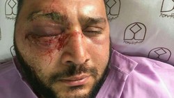 هوادار مضروب پرسپولیس: به CAS شکایت خواهم کرد