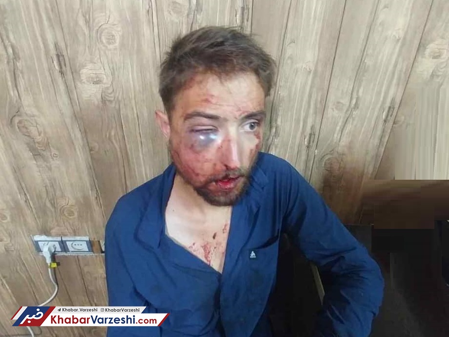 عکس| بلایی که در ایران سر دوچرخه‌سوار آلمانی آوردند